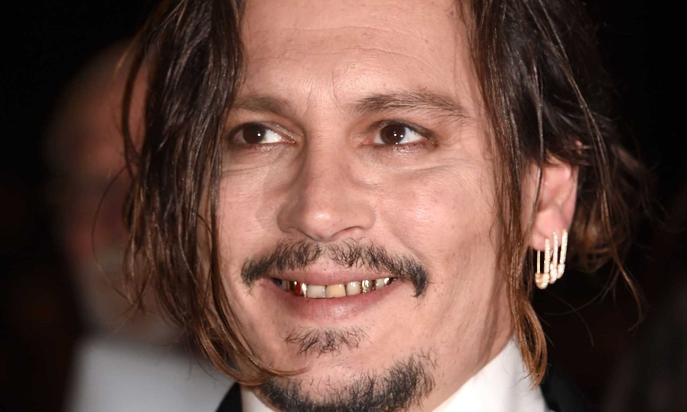 Johnny Depp's Teeth 2022