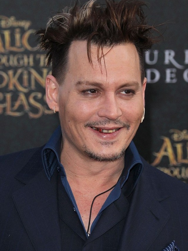 What Happened To Johnny Depp’s Teeth